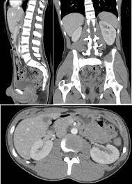 Image slices that ct scans produce can. Computed Tomography Of The Abdomen And Pelvis Wikipedia