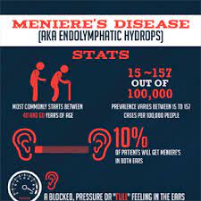 The Natural Course Of Meniere S Disease
