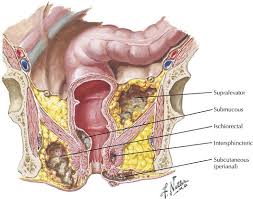 Image result for Ischiorectal Abscess