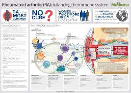 Rheumatoid Arthritis Balancing The Immune System Fx Medicine