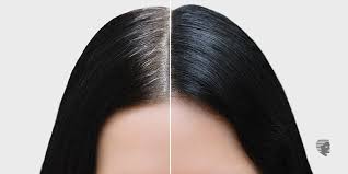 The term premature grey hair is used to describe a situation whereby an individual has more than 50 percent graying of hair while aged below 40 years. Premature Greying Of Hair Causes Tips For Treatments Ahs India