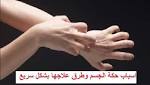 اسباب حكة الجسم وطرق علاجها