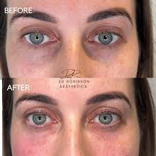 Dr Ed Robinson Aesthetics