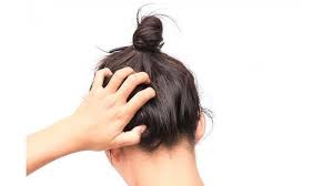 Mar 3, 2019 masalah rambut dan kulit kepala bisa sangat menjengkelkan, tetapi jangan khawatir karena. Punya Masalah Kulit Kepala Yang Gatal Ternyata 3 Hal Ini Bisa Menjadi Penyebabnya Blog Tribunjualbeli Com