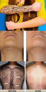 сколько стоит кольцо с бриллиантом в 0 5 карат Ubiraem Volosy Navsegda 7 Proverennyh Receptov Life Hacks Beauty Beauty Hacks Beauty Skin