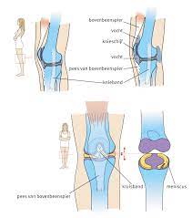 Ik Heb Een Gescheurde Meniscus Thuisarts Gescheurde Meniscus Jicht Spierpijn