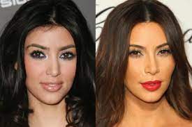 Cosmetic surgery's goal is to improve your appearance. Has Kim Kardashian Had Cosmetic Surgery