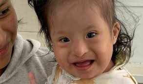 Success! Maria from Bolivia raised $1,500 to fund the surgical closure of  two small holes in her heart.