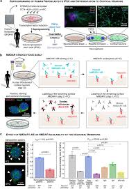 De beste vinene til pinnekjøtt og ribbe. All Naturally Occurring Autoantibodies Against The Nmda Receptor Subunit Nr1 Have Pathogenic Potential Irrespective Of Epitope And Immunoglobulin Class Molecular Psychiatry