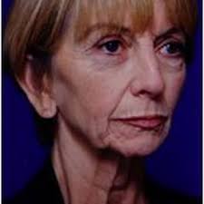 RICHARD ELLENBOGEN, MD