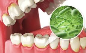 Gastroesophageal reflux is a disease or reflex which occurs when the lower esophageal sphincter, located in the diaphragm isolating the esophagus from burning sensation in the throat when stomach juices reach the mouth. How To Treat Bad Breath From Acid Reflux