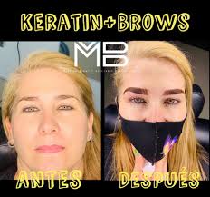 MB alaciados profesionales