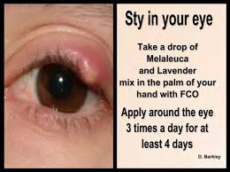 Eye Sty Essential Oils For Stye Stye Treatment Eye Stye Remedies