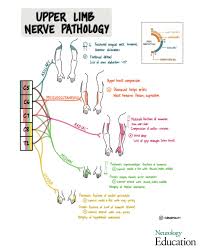 Image result for Neurologic Lesion Localization