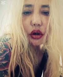 Calvario de actriz de 'Isabel' (TVE) por la mala praxis de un cirujano:  destrozo en la cara, "viva de milagro"