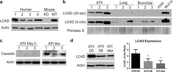 Hypoglycemia is when the level of sugar (glucose) in the blood is too low. Long Chain Acyl Coa Dehydrogenase Deficiency As A Cause Of Pulmonary Surfactant Dysfunction Journal Of Biological Chemistry