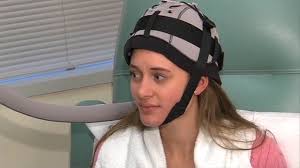 Cold cap to prevent hair loss during chemo. Scalp Cooling Reduces Chemotherapy Induced Hair Loss Consult Qd