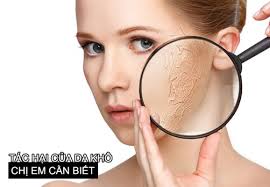 5 Tác hại của da khô chị em phụ nữ cần phải biết