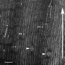 Cytokinesis in plant cell division occurs initially by the formation of a(n). The Role Of The Cytoskeleton And Associated Proteins In Determination Of The Plant Cell Division Plane Rasmussen 2013 The Plant Journal Wiley Online Library