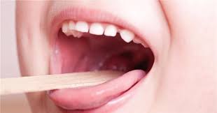 اعراض التهاب اللوزتين تغير في الصوت عند الحديث وعند حدوث التهاب في اللوزتين عند الأطفال تكون من أعراض المغص والقيء والغثيان علاج اللوزتين بسبب الالتهاب البكتيري. Ø§Ù„ØªÙ‡Ø§Ø¨ Ø§Ù„Ø­Ù„Ù‚ Ø§Ù„Ø¨ÙƒØªÙŠØ±ÙŠ Ø¹Ù†Ø¯ Ø§Ù„Ø§Ø·ÙØ§Ù„ Ù„Ù‡Ù„ÙˆØ¨Ù‡