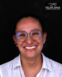 Diseño De Sonrisa y Ortodoncia Invisible Cali 🇨🇴 (@dr.felipenava) •  Instagram photos and videos