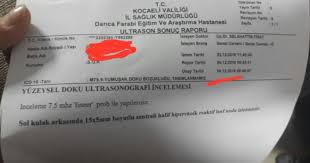 Lenfoma hastalığı tedavisi var mi? Lenf Nodu Hakkinda Bilgisi Olan Varsa Bir Gelebilir Mj Kizlarsoruyor