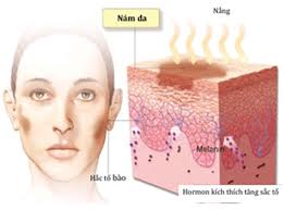 Kết quả hình ảnh cho HÌNH ẢNH TRỊ NÁM CON GÁI