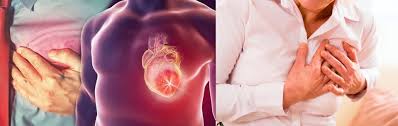 Aceasta afectiune este frecventa in tarile dezvoltate, acolo unde aceasta afectiune cardiovasculara reprezinta o comuna. Durerea In Piept Angina PectoralÄƒ Clinica De Cardiologie Cardioclass