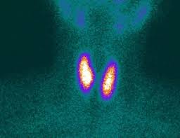 Thyroid Scan Nuclear Medicine Prenatal Development Medical