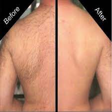 When men talk about how to shave your back. How To Get Rid Of Back Hair Permanently Back Hair Removal Hair Removal For Men Best Hair Removal Products