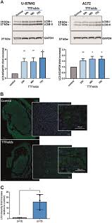 Diagram pdf sony kv 1435 diagram pdf 9 out of 10 based on 40 ratings. Ampk Dependent Autophagy Upregulation Serves As A Survival Mechanism In Response To Tumor Treating Fields Ttfields Cell Death Disease