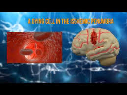 Your brain does eventually heal itself. Can The Brain Heal After A Stroke Lagu Mp3 Mp3 Dragon
