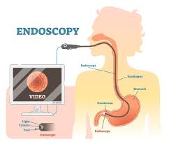 Esophagitis Guide Causes Symptoms And Treatment Options