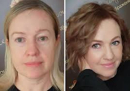 Before and after! What do you think of the change? 😍