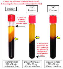 Prf strives for excellence as a service provider of engineering, construction and maintenance, throughout the sector of combustible gases. Although Recent Attempts Have Been Made Comparing L Prf Protocols A Download Scientific Diagram