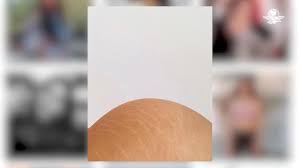 Esmeralda Pimentel muestra orgullosa su cuerpo desnudo con estrías