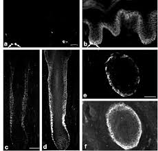 View below our library of normal moles pictures. K19 And A3b1 Integrin Expression In Cells From Hairy And Glabrous Download Scientific Diagram