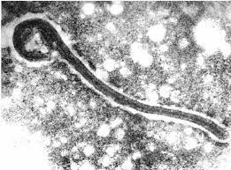 The marburgvirus genus includes two viruses. The First Electron Micrograph Of A Marburg Virion From 1967 Image Download Scientific Diagram