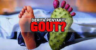 Tidak berpantang makan dan kurang amalkan gaya hidup sihat memungkinkan anda diserang gout. Punca Gejala Tanda Gout Serta Cara Ubat Gout Secara Tradisional Biskut Tawar