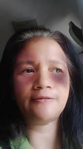 Reels viewers and likers