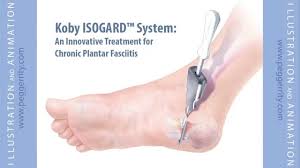 Plantar Fasciitis Surgical Treatment Animation By Certified Medical Illustrator Peg Gerrity Youtube