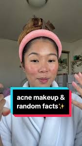 get to know me part ✌🏼 #acnemakeup #acne
