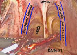 We did not find results for: Laparoscopic Surgical Anatomy For Pelvic Floor Surgery Sciencedirect