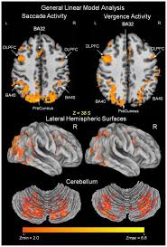 The Eye Brain Continuum Fmri Style Brain Images Brain Continuum