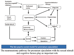 Premature ejaculation can be frustrating to couples. Understanding The Pathophysiology Of Premature Ejaculation Bridging The Link Between Pharmacological And Psychological Interventions Bentham Science