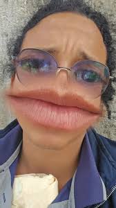 Talves se vuelve viral: La risa detrás del poporopo