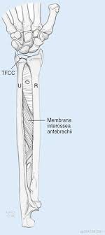 Läsionen des tfcc können traumatischer oder degenerativer genese sein. Die Behandlung Der Arthrose Des Distalen Radioulnargelenks Springerlink