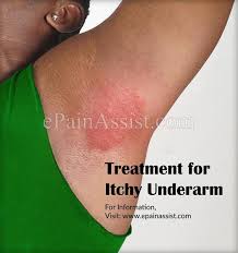 How To Heal Armpit Rashes Itchy Underarms Armpit Rash Armpit Detox