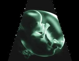 Wenn das mein herzschlag gewesen wäre hätte ich kurz vor´m herzinfarkt gestanden, denn der war super schnell und mein. Babys Im Mutterleib Was Tut Ihnen Gut Was Schadet Ihnen Vaterfreuden De Die Seite Fur Vater
