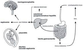 When should listeriosis be suspected? Schematic Representation Of The Pathophysiology Of Listeria Infection Download Scientific Diagram